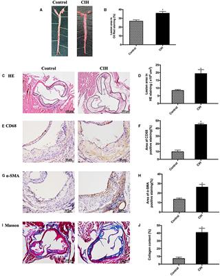 Brown Adipose Tissue Activation Is Involved in Atherosclerosis of ApoE−/− Mice Induced by Chronic Intermittent Hypoxia